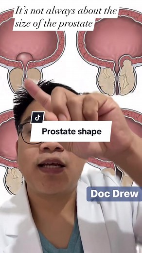 Understanding the Shape of the Prostate | Health, Fitness & Wellness