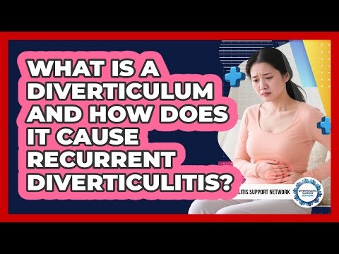 What Is A Diverticulum And How Does It Cause Recurrent Diverticulitis?