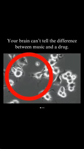 This is why certain songs feel more addictive than anything else in life. Your brain doesn’t separate dopamine hits. Whether it comes from sex, food, gambling, drugs, or a perfectly designed chorus: the brain chemistry is the same. Pleasure, craving, repeat. When a songwriter stacks the right rhythm patterns with dopamine-triggering intervals or syncopation or hit song melody patterns, the brain reacts as if you’ve taken a hit of something chemical. That’s why people binge songs on repeat for ho