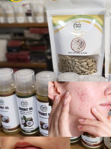 “3 Benefits of Mulethi (Licorice Root)” Mulethi is more than just a throat herb. Here are 3 common benefits people use it for. ✔ Throat comfort ✔ Digestion support ✔ Skin soothing 🎥 Full explanation & precautions → https://youtu.be/joDm_EnhrhU #Mulethi #HerbalTok #Pumpkinseeds #NaturalHealth #LicoriceRoot