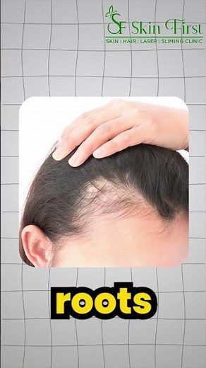 Causes of Hair Fall Explained | Expert Advice from Skin First Clinic 💇‍♀️🌿