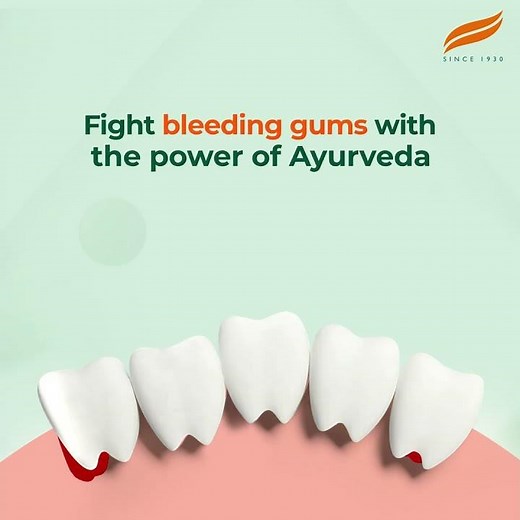 Cure bleeding gums with Himalaya Ayurveda Gum Care