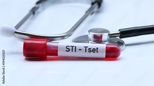 STI test to look for abnormalities from blood, blood sample to analyze in the laboratory, blood in test tube