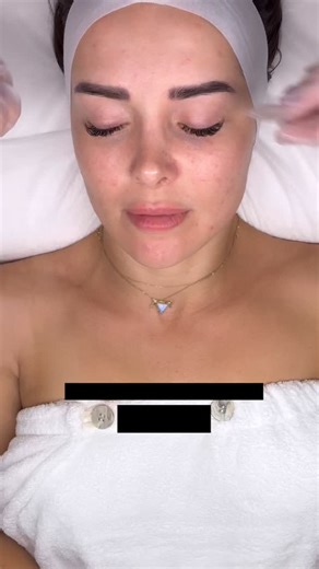 DOWN HERE 👇 ✨Advanced skin regeneration, done properly. ✨ Microneedling creates the perfect environment for powerful skin infusions and when paired with Exosomes and Rejuran, results are taken to the next level. 🧬 Exosomes help signal the skin to repair, regenerate and boost collagen production. 🧬 Rejuran (polynucleotides) works to heal damaged skin, improve elasticity and strengthen overall skin quality. This combination supports smoother texture, improved firmness, enhanced glow and long-te