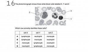 The photomicrograph shows three white blood cells labelled X, Y... | Filo