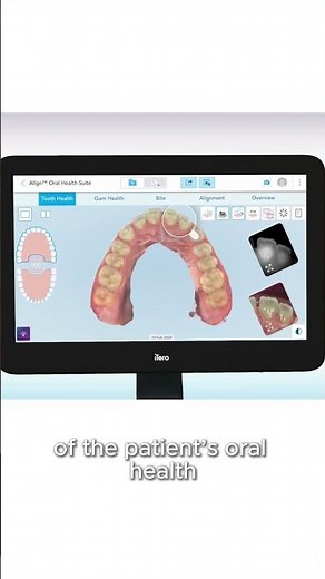 Discover new tools in the Align™ Oral Health Suite