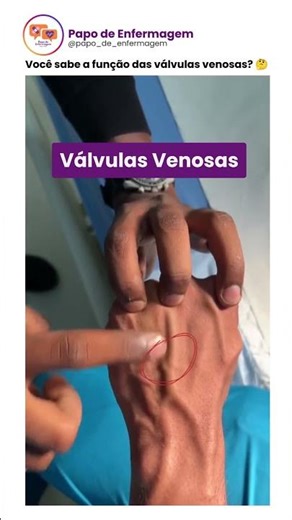 Você sabe o que são e para que servem as válvulas venosas?