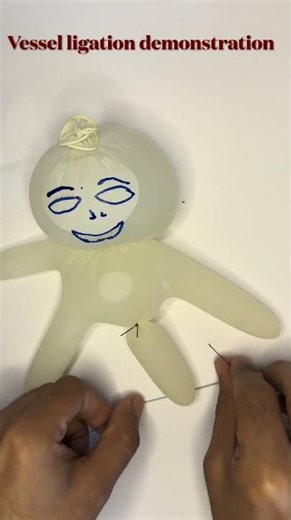 How to Ligate a Vessel: Surgical Knot Technique | Essential Surgical Skill Demo #suturing #surgery