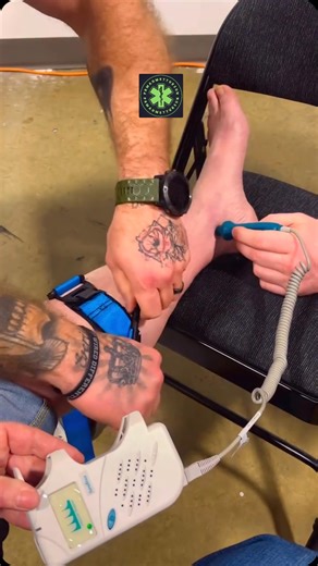 Ahmet Tursun on Instagram: "Bir taktik muharebe turnikesinin arter (atardamar) üzerindeki etkisini, perifere giden kan akımı nasıl durdurduğunu görüyorsunuz. Ayrıca uygulama bölgesi tibia fibula yani çift kemik olan bölge. CoTCCC güncel klavuzlarında çift kemik üzerine turnike uygulanabileceği söylenmektedir. Muharebe turnikesi ulaşması ve kullanması kolay bir ekipman olup, kanama kaynaklı mortalite oranına etkisi yüksektir. Hangi yaralanmalarda muharebe turnikesi kullanmalıyız ? Her kanamaya tu