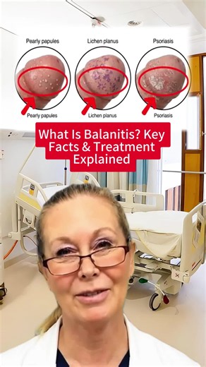 Balanitis: causes, symptoms and essential treatment tips