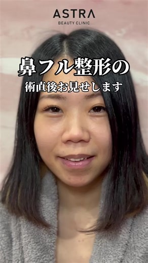 鼻フルの術直後のプロセスをご紹介💖