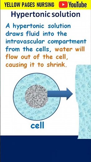 Hypertonic solution | IV Fluids | Intravenous fluids |Crystalloids |