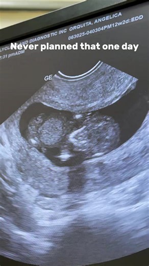 Coping with Grief After Miscarriage and Moving Forward