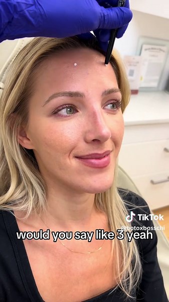 Achieve Perfect Eyebrow Symmetry with Botox