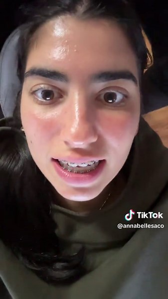 Teeth are looking GOOD!! #braces #bracesappointment #bracescheckin #appointment #ortho #orthodontist #comewithme #vlog #teeth