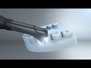 Welcome to DEXIS CariVu™, transillumination caries detection device