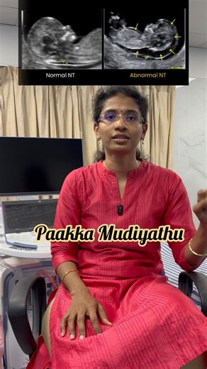 3 Benefits of 3rd month Scan #pregnant #pregnancyscan