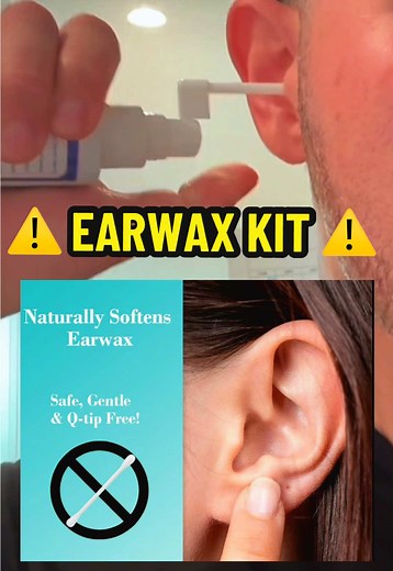 Earwax Removal Spray 💥👂🏼 7 Day Treatment 🍃 Clear All That 🕯️ Wax ASAP‼️ #EarWax #EarCare #EarWaxRemoval #EarDrops #Headot #Fyp #ForYouPage #tutorial #learn #learnontiktok #tutorials #beautytips #asmr #asmrsounds #barber #barbershop #beauty #beautyhacks