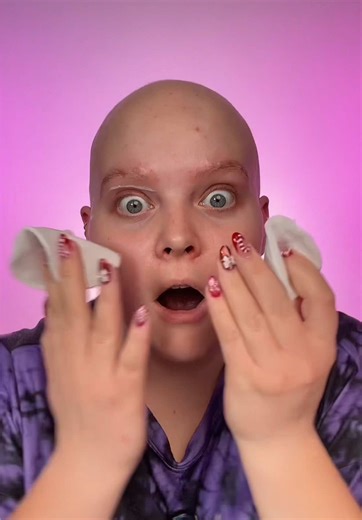 Alopecia und Augenbrauenblondieren: Was jetzt?