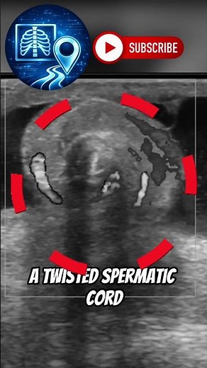 Miss This… and the Testicle Is Gone