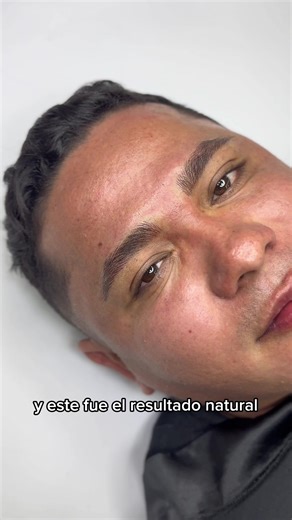 ✨ Cejas masculinas naturales a través de la micropigmentación La micropigmentación de cejas es un procedimiento diseñado para lograr un resultado sutil, delicado y completamente adaptado al rostro masculino 💯 En la micropigmentación de cejas respetamos el crecimiento natural del vello, evitando efectos marcados o artificiales, logrando una apariencia más definida pero totalmente discreta 👌🏼 📍 Cúcuta, Colombia 📲 Agenda tu cita: 321 480 1148 #cejas #micropigmentación #micropigmentacióncucuta 