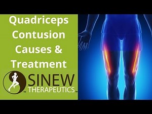 Quadriceps Contusion Causes and Treatment
