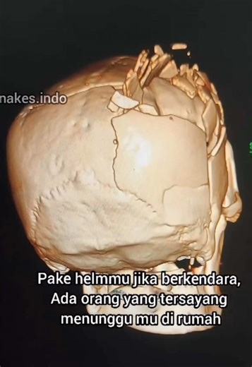 Peran Tenaga Kesehatan dalam Proses CT Scan