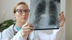 Female doctor examines x-ray of lungs, holding it in hands indoors. Specialist holds transparent image of chest in arms, and carefully researches it. Experienced expert dressed in white medical