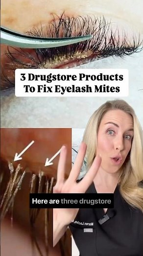 Fix Eyelash MITES! 😮
