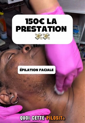 T’as déjà vu un visage aussi poilu toi ? #epilation #institutdebeauté