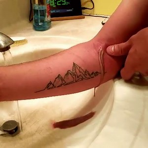 433K views · 485 reactions | Crazy abscess  | Spot Popping Satisfaction | Facebook