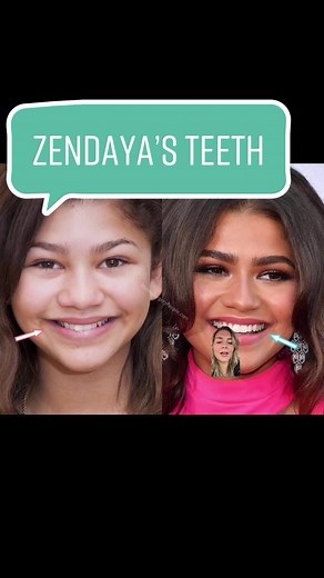 Zendaya’s teeth #zendaya Also I said her name wrong don’t hate me 🥺 | zendaya