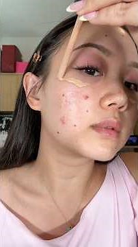 Full makeup tutorial on acne prone skin 🎀☁️ #acne #makeuptutorial