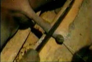 Circoncision au Sénégal