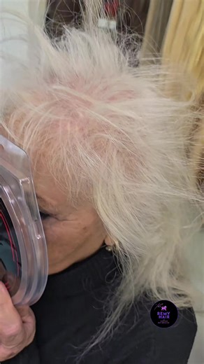 Capelli diradati che non crescono? Abbiamo la soluzione! La nostra estensione NDV è l'applicazione più moderna e perfetta: senza colla, trecce, cheratina o trazioni. Solo 30 minuti per una chioma naturale, leggera e senza danni. ✨ 📍 Via dei Colli Albani 9, Roma 📞 3661167566 ☎️ 06 7811762