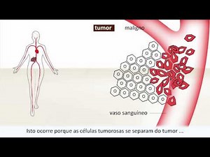 Câncer - Causa e tratamento