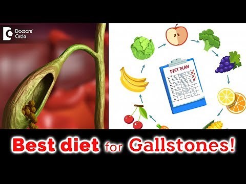 Food and drinks to eat and avoid if you have Gallstones - Dr. Nanda Rajaneesh | Doctors' Circle