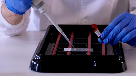 肝脂肪症評価のための3D再構成による蛍光染色された脂肪滴の分析
