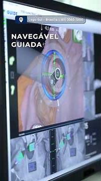Navegada Guiada - O futuro dos implantes dentários