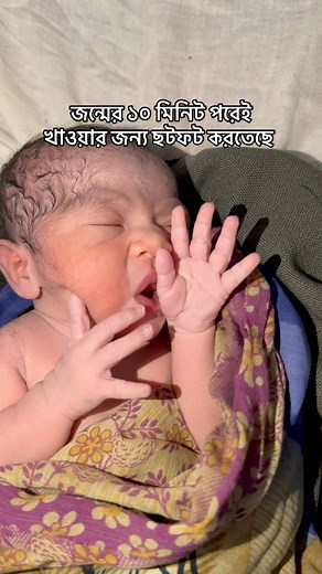 149K views · 5.6K reactions | Hungary newborn baby #newborn #healthtipsforyou | Dr. Ataur Rahman, Osteopathic & Chiropractic | Facebook