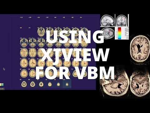 Using xjView for VBM