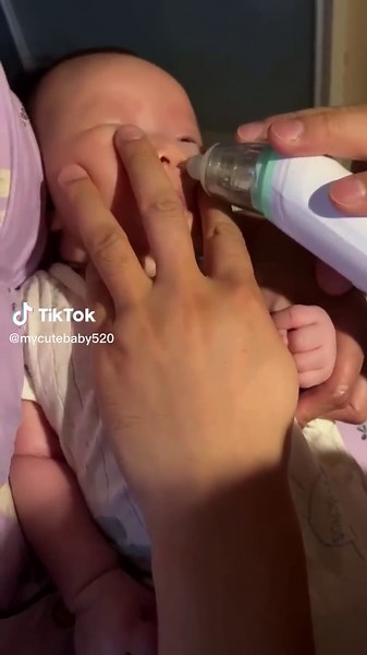 How to Use a Nasal Aspirator on Infants Effectively