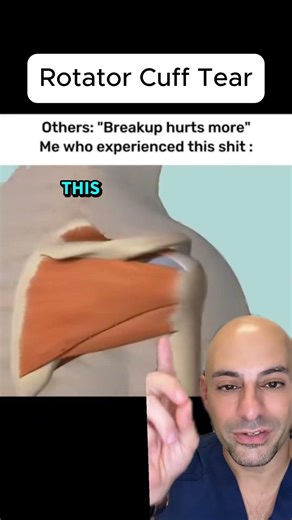 How rotator cuff tears ACTUALLY happen...