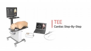 TEE - Cardiac step-by-step