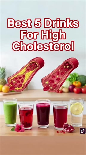 Best 5 Drinks for High Cholesterol It's known as the silent killer. Excess LDL (bad) cholesterol accumulates on the walls of arteries, gradually narrowing blood vessels and increasing the risk of heart disease. 1) Green tea It contains powerful antioxidants called catechins. These compounds may reduce the amount of cholesterol the body absorbs and promote healthier blood vessels over time. When drinking green tea becomes a daily habit, it helps lower levels of bad cholesterol (LDL) and reduce ox
