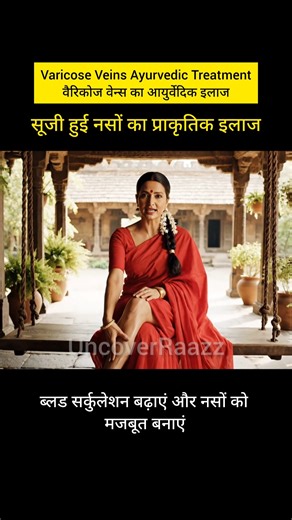 Varicose Veins Ayurvedic Treatment | Herbs, Oil Massage | Health & fitness #viral #shorts #healing