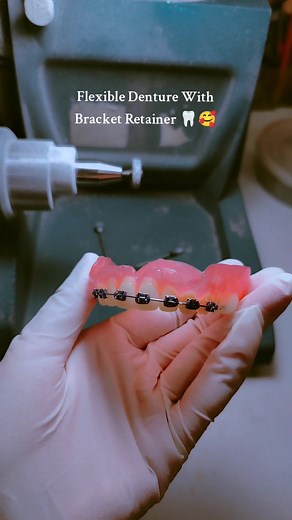 Discover Flexible Dentures for Ultimate Comfort