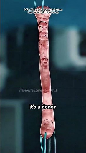 How ACL Surgery Is Performed (3D Animation)