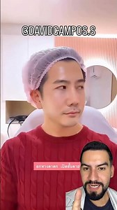 Facial Thread Lifts: What You Need to Know