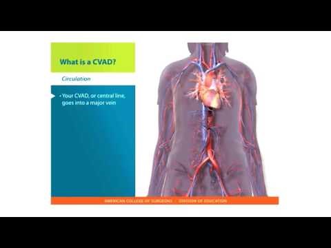 Central Lines Skills: What is a CVAD